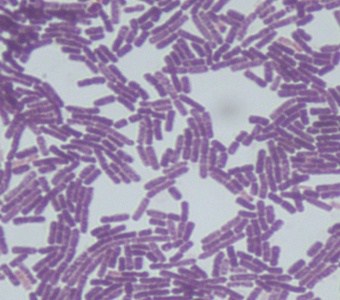 Bacillus thuringensis
